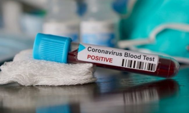 Veneto: salgono a 3484 i positivi al Covid-19, 209 i ricoverati in terapia intensiva